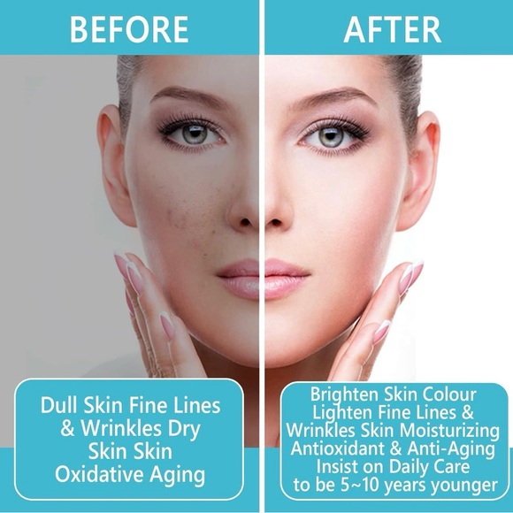 Hyaluronic Acid Serum - Green - Picture 7 of 8